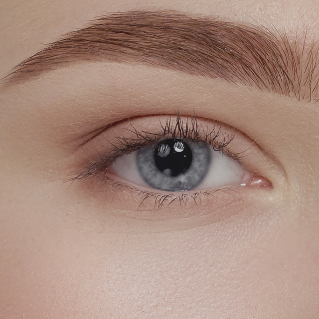 Blepharoplasty