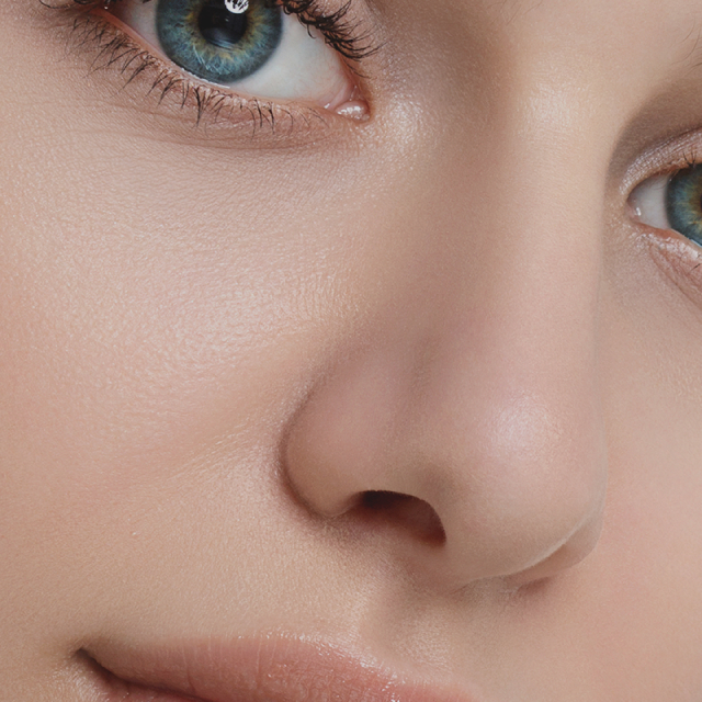 Rhinoplasty